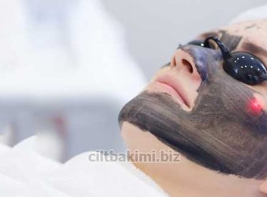 Karbon Peeling Nedir Nasıl Yapılır