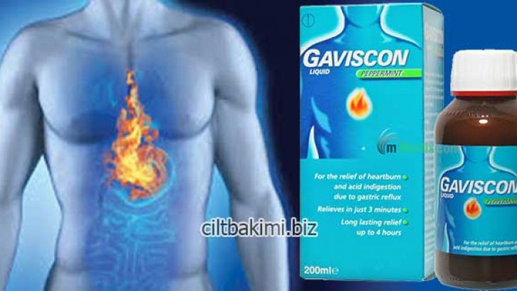 Gaviscon Nedir Gaviscon Ne İşe Yarar Gaviscon Şurup